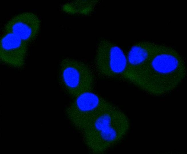 Anti-Phospho-NTRK2 (Tyr817) Antibody (6J201)