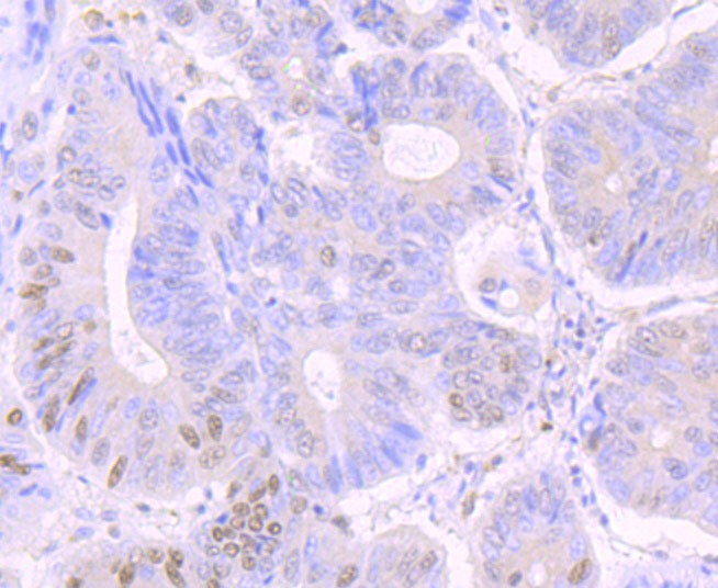 Anti-Phospho-CREB1 (Ser133) Antibody (4I795)