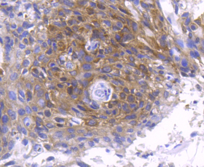 Anti-Phospho-PRKCZ (Thr560) Antibody (2L99)
