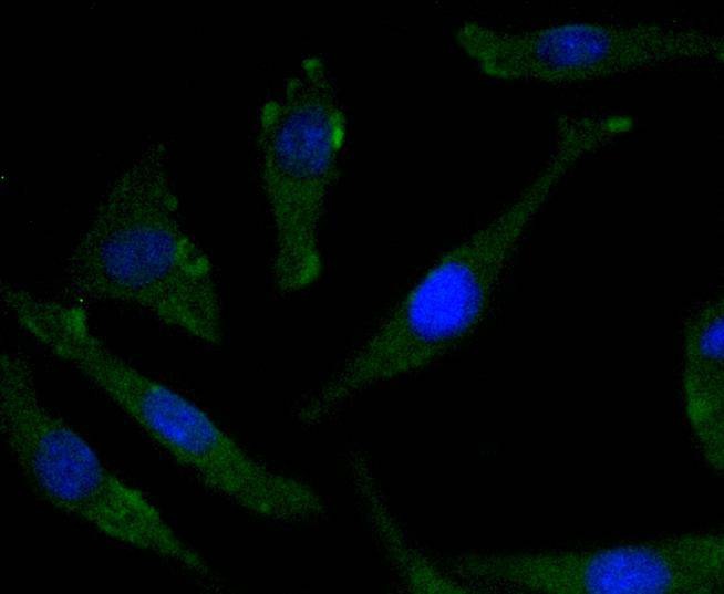 Anti-Phospho-NTRK2 (Tyr817) Antibody (6J201)