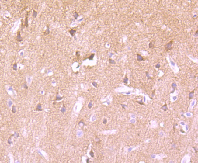 Anti-Phospho-PRKCA (Thr638) Antibody (1C677)