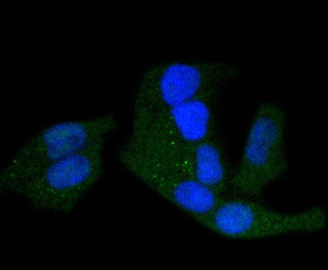 Anti-Phospho-PRKAR2A (Ser99) Antibody (9R534)
