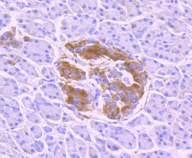 Anti-Phospho-NTRK2 (Tyr817) Antibody (6J201)