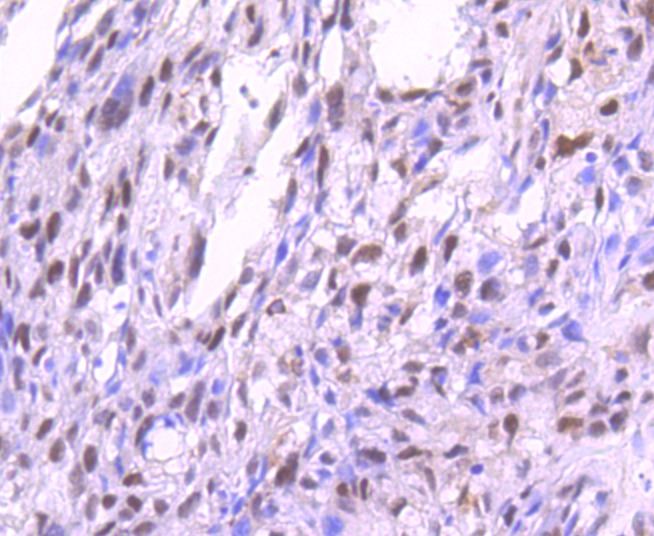 Anti-Phospho-PRKCA (Thr638) Antibody (1C677)