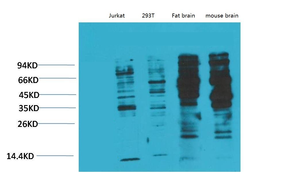 Anti-Phosphotyrosine Antibody (4V357)