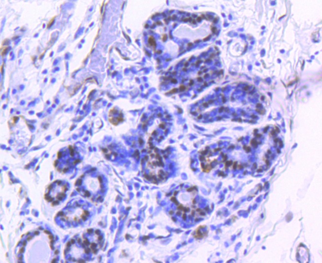 Anti-Phospho-YAP1 (Ser127) Antibody (5V148)