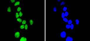 Anti-Phospho-CCNE1 (Thr77) Antibody (8N839)