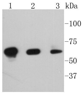 Anti-Phospho-PAK1/2/3 (Ser139) Antibody (4F435)