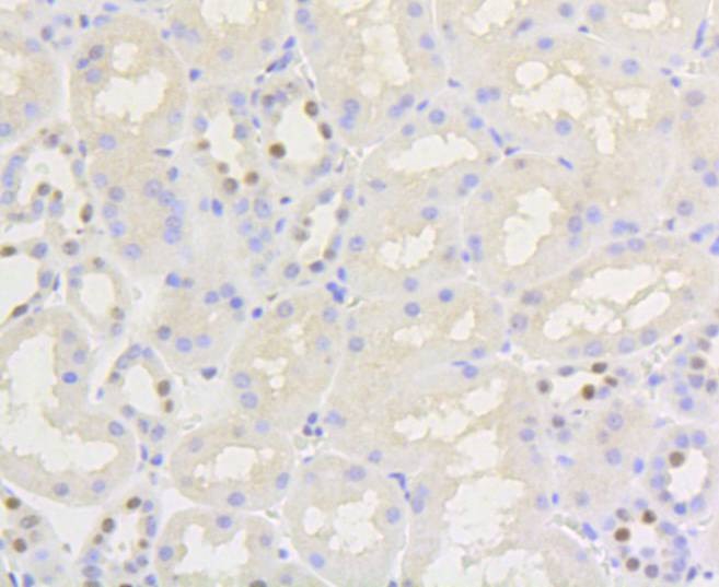 Anti-Phospho-NFE2L2 (Ser40) Antibody (7L44)
