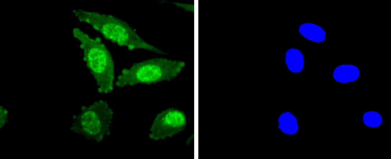 Anti-Phospho-PRKCA (Thr638) Antibody (1C677)