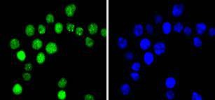 Anti-Phospho-CCNE1 (Thr77) Antibody (8N839)