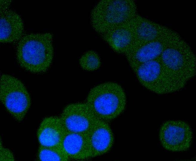Anti-Phospho-PRKAR2A (Ser99) Antibody (9R534)