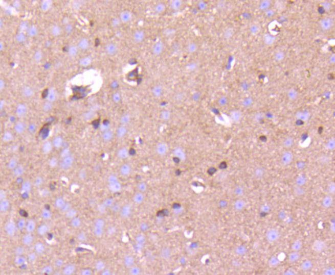 Anti-Phospho-PAK1/2/3 (Ser139) Antibody (4F435)