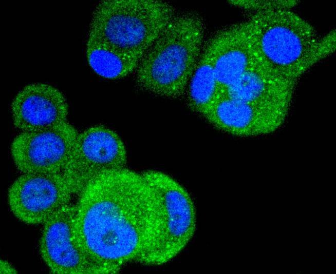 Anti-Phospho-BRAF (Thr401) Antibody (6W728)