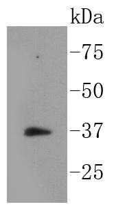 Anti-Phospho-NFKBIA (Ser32) Antibody (6R546)