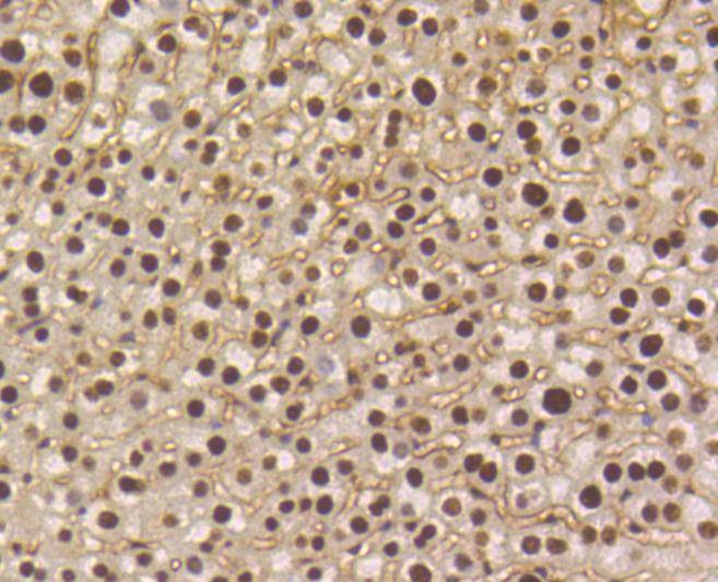 Anti-Phospho-SMAD5 (Ser463, 465) Antibody (2F385)