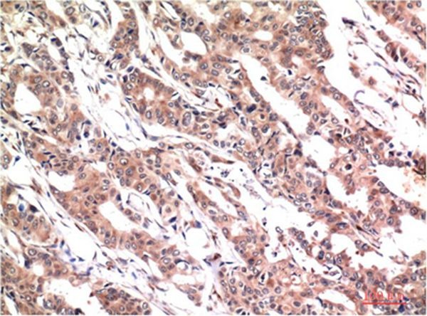 Anti-Phospho-STAT3 (Tyr705) Antibody (2P792)