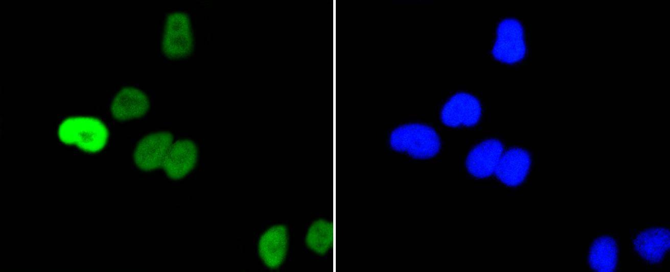 Anti-Phospho-MYC (Ser62) Antibody (5I19)
