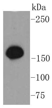 Anti-Phospho-SMC1A (Ser957) Antibody (1H28)