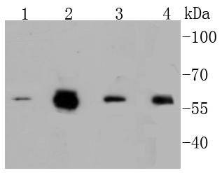 Anti-Phospho-MYC (Ser62) Antibody (5I19)