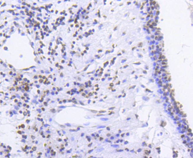 Anti-Phospho-SMC1A (Ser957) Antibody (1H28)