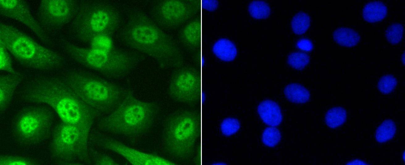 Anti-Phospho-SMAD5 (Ser463, 465) Antibody (2F385)