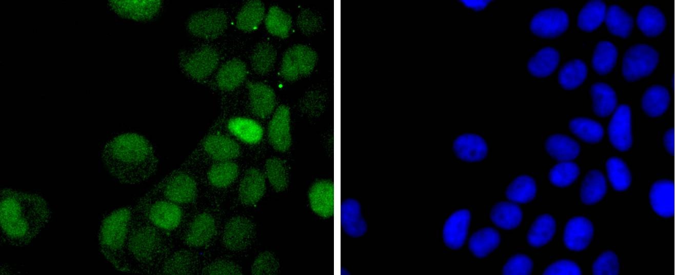 Anti-Phospho-JUN (Thr91) Antibody (2Q8)