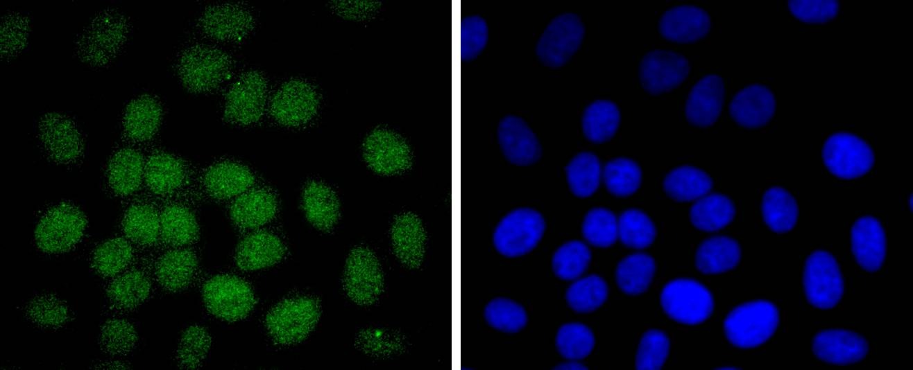 Anti-Phospho-JUN (Thr91) Antibody (2Q8)