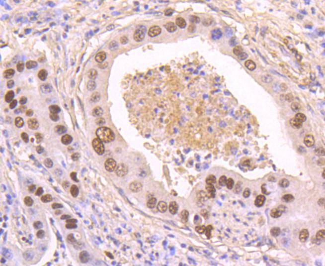 Anti-Phospho-p53 (Ser392) Antibody (2F452)