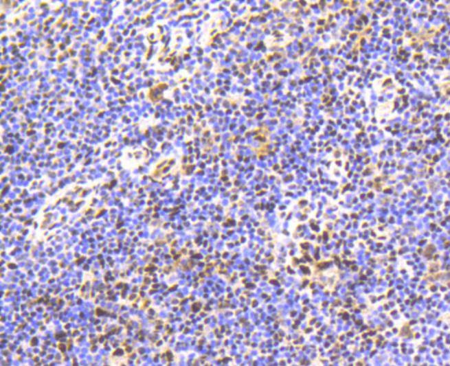 Anti-Phospho-SMAD5 (Ser463, 465) Antibody (2F385)