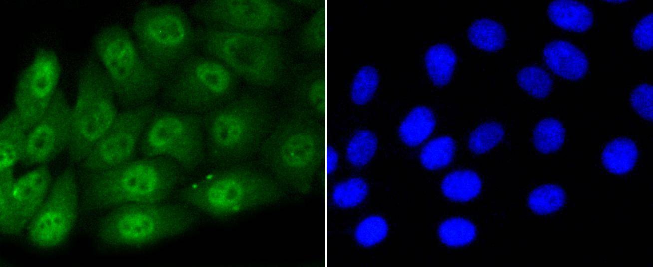 Anti-Phospho-SMAD5 (Ser463, 465) Antibody (2F385)