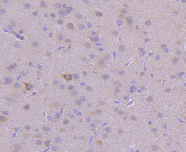 Anti-PI 3 Kinase Class 3 Antibody (2W658)