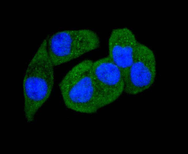 Anti-Phospho-PAK1/2/3 (Ser139) Antibody (4F435)
