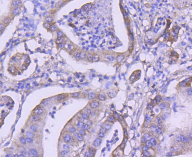 Anti-PI 3 Kinase Class 3 Antibody (2W658)