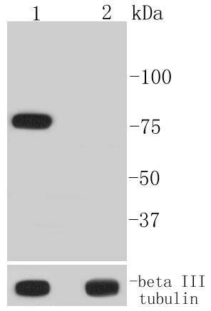 Anti-Phospho-BTK (Tyr223) Antibody (1E544)