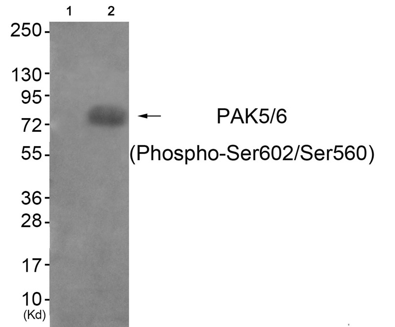 Anti-Phospho-PAK5/6 (Ser602/560) Polyclonal Antibody
