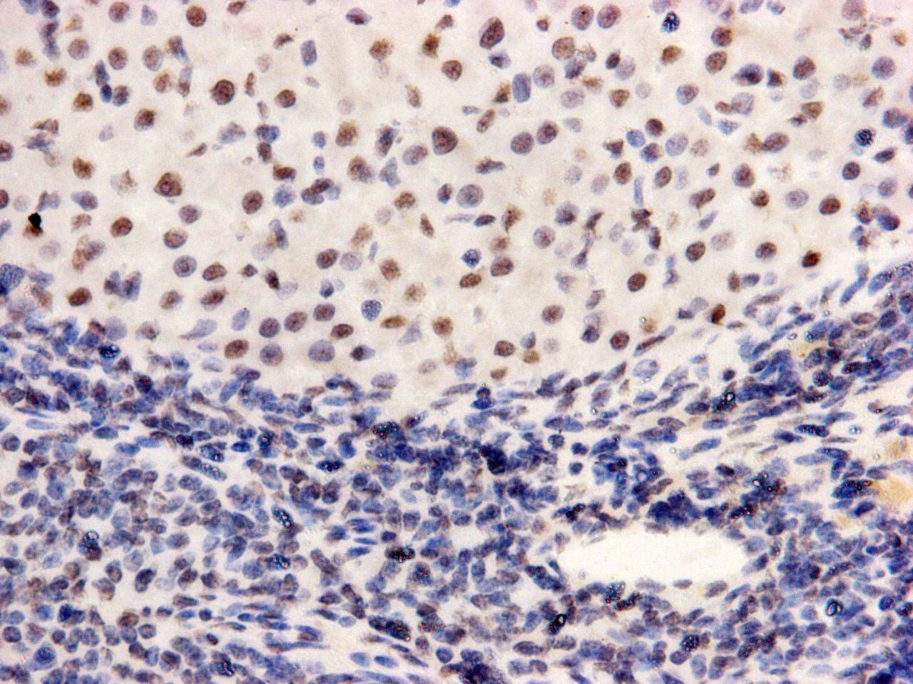 Anti-PGBD5 Antibody (3L250)