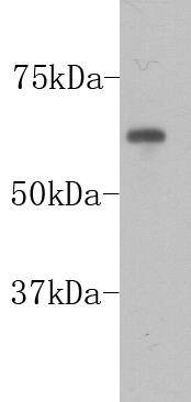 Anti-PGBD5 Antibody (3L250)