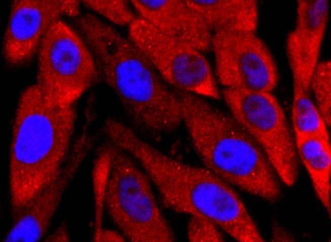 Anti-UCHL1 Antibody (8X527)