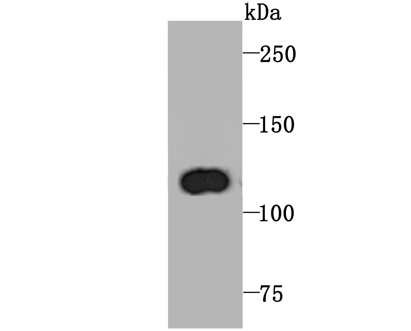 Anti-PGC-1 beta Antibody (2Y825)