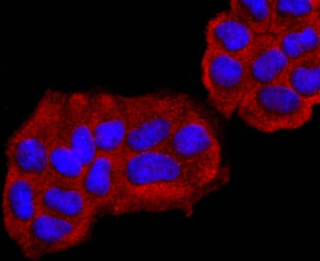 Anti-UCHL1 Antibody (8X527)