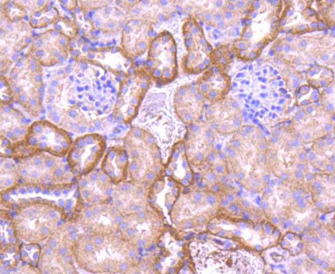 Anti-CDH1 Antibody (5F903)
