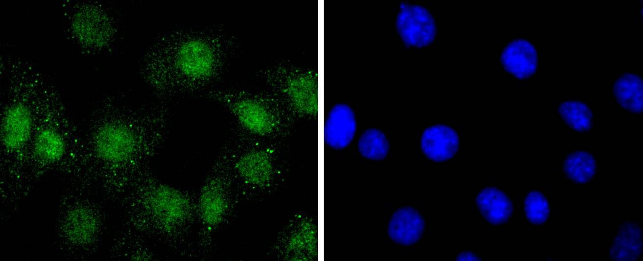 Anti-Phospho-AKT1 (Ser124) Antibody (1H96)