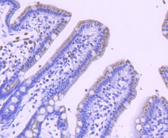 Anti-PFKFB3 Antibody (1B165)