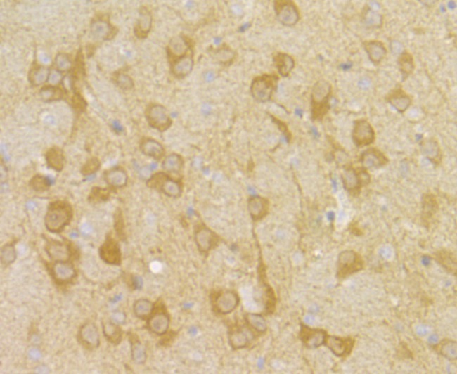 Anti-PGAM1 Antibody (6H458)