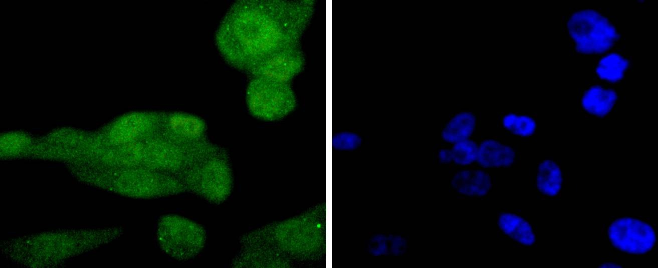 Anti-Phospho-AKT1 (Ser124) Antibody (1H96)