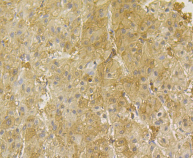 Anti-PGAM1 Antibody (6H458)