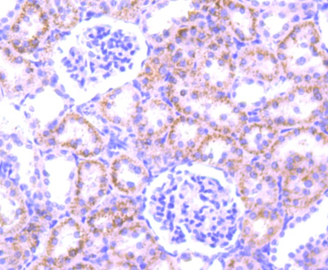 Anti-PFKFB3 Antibody (1B165)