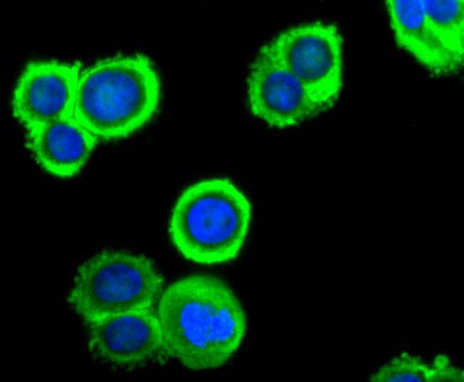 Anti-Peroxiredoxin 2 Antibody (6A598)