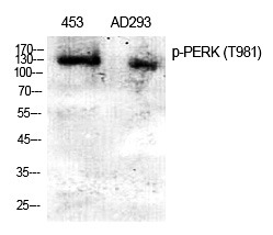 Anti-Phospho-PERK (Thr982) Polyclonal Antibody